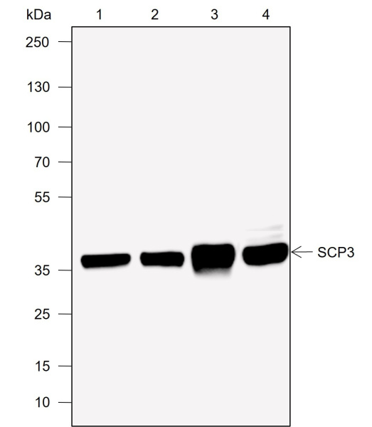 Recombinant SCP3 Monoclonal Antibody (AN301999L)