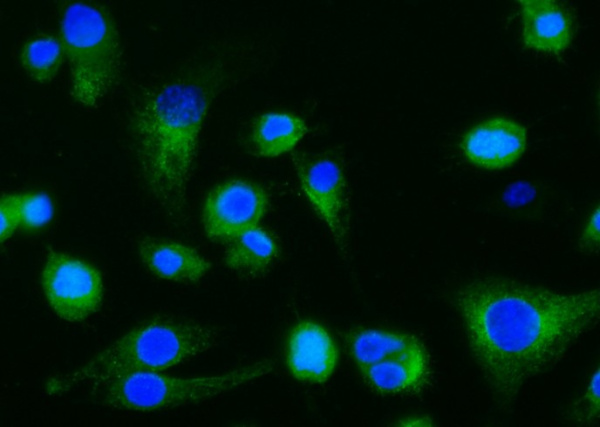 Recombinant Dectin-1/CLEC7A Monoclonal Antibody (AN300495P)