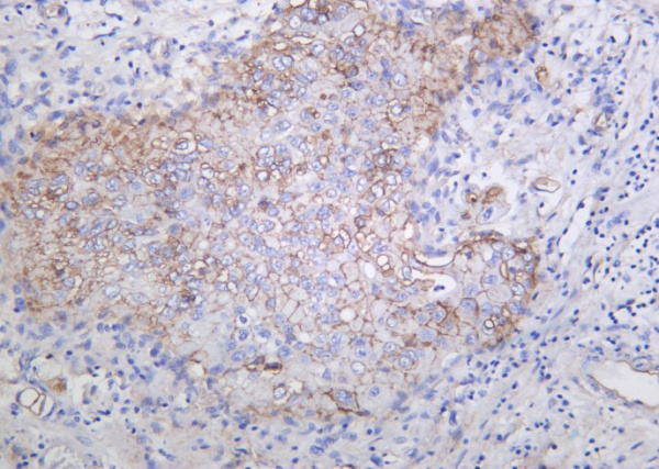 Recombinant Integrin αV Monoclonal Antibody (AN301281L)