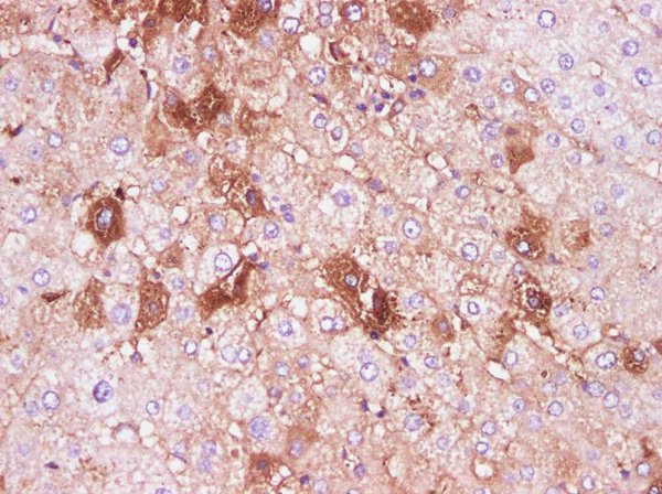IL-6 Polyclonal Antibody (AN005790L)