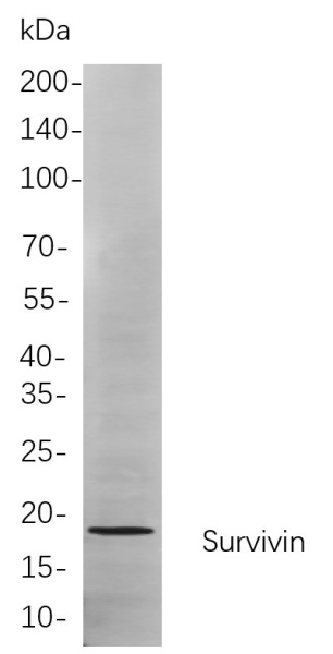 Recombinant Survivin Monoclonal Antibody (AN301000L)