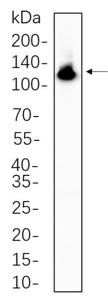 Recombinant NFkB-p100 Monoclonal Antibody (AN300722L)