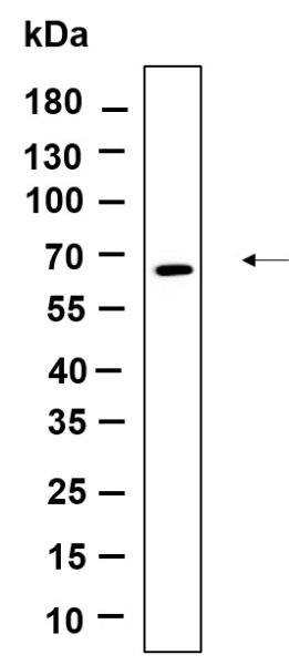 Recombinant Fyn Monoclonal Antibody (AN301178L)