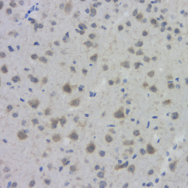 ACHE Polyclonal Antibody (E-AB-70015)