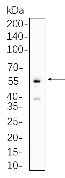 Recombinant Parkin Monoclonal Antibody (AN300694L)