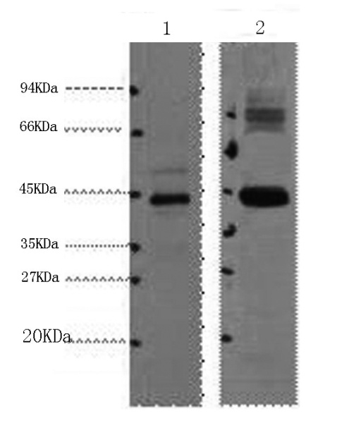 AMACR Monoclonal Antibody (E-AB-22010)