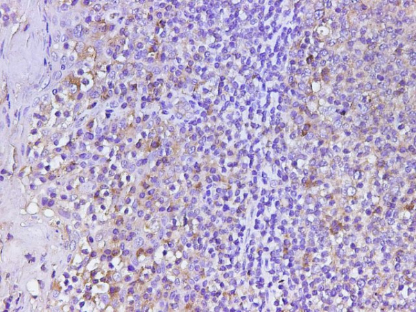 CD74 Polyclonal Antibody (D-AB-10370L)