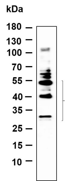 Recombinant BNIP-3 Monoclonal Antibody (AN301126L)