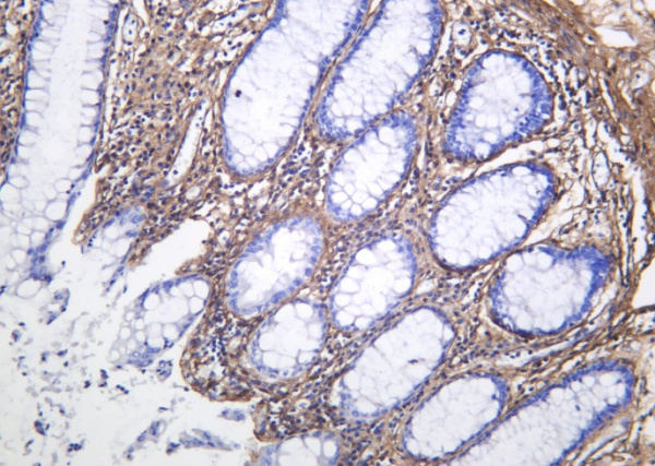 Recombinant Collagen VI Monoclonal Antibody (AN301269L)