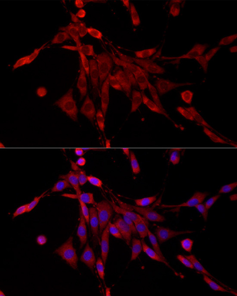 PDE4C Polyclonal Antibody (E-AB-90559)