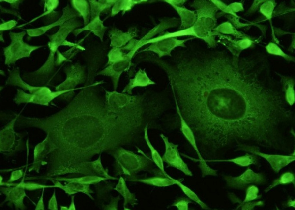 Recombinant SOD1/Superoxide Dismutase Monoclonal Antibody (AN300037P)