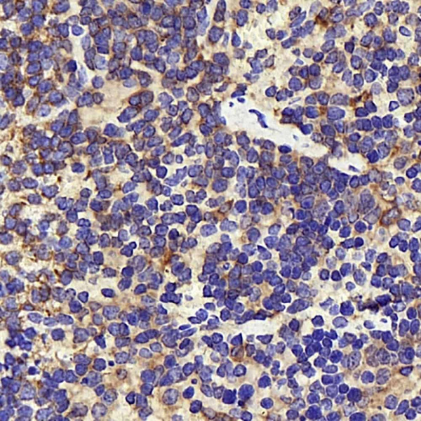 INPP5D Polyclonal Antibody (E-AB-70200)