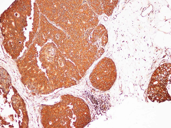 S100A9 Polyclonal Antibody (E-AB-40316)
