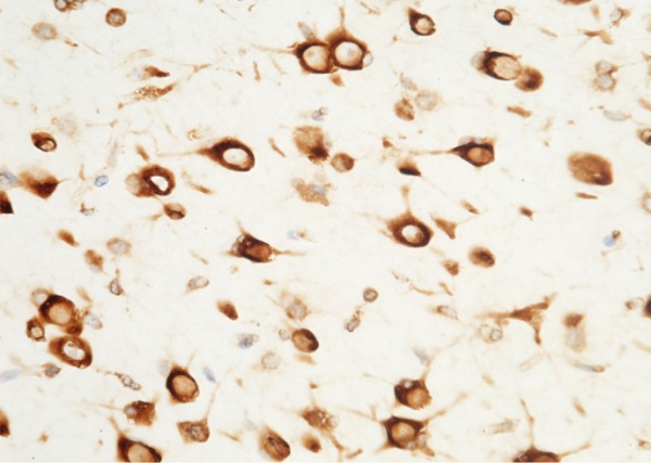Recombinant SerpinF2 Monoclonal Antibody (AN300315P)