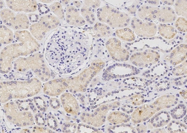 PHYH Monoclonal Antibody (AN200137P)