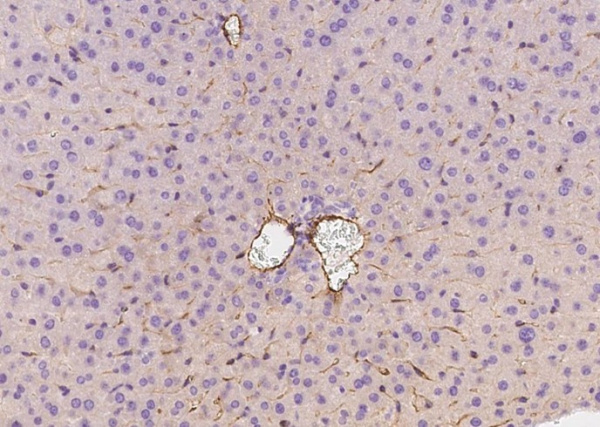 Recombinant CD146/MCAM Monoclonal Antibody (AN300560P)
