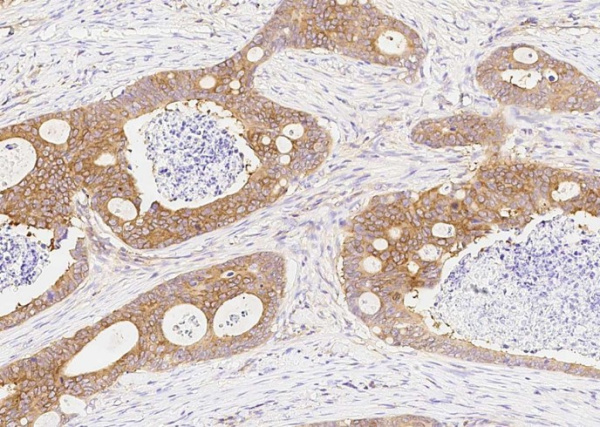 DARS Monoclonal Antibody (AN200238P)