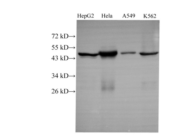 CK-18 Polyclonal Antibody (D-AB-10222L)