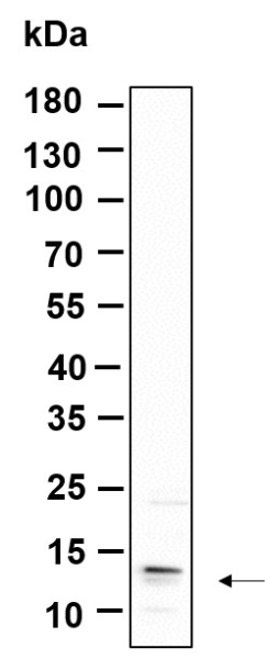 Recombinant C17orf61 Monoclonal Antibody (AN301196L)