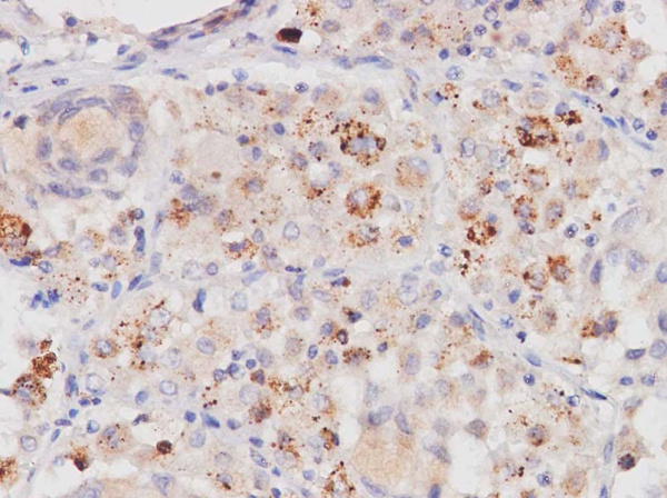 PDGF-AA Polyclonal Antibody (AN005890L)