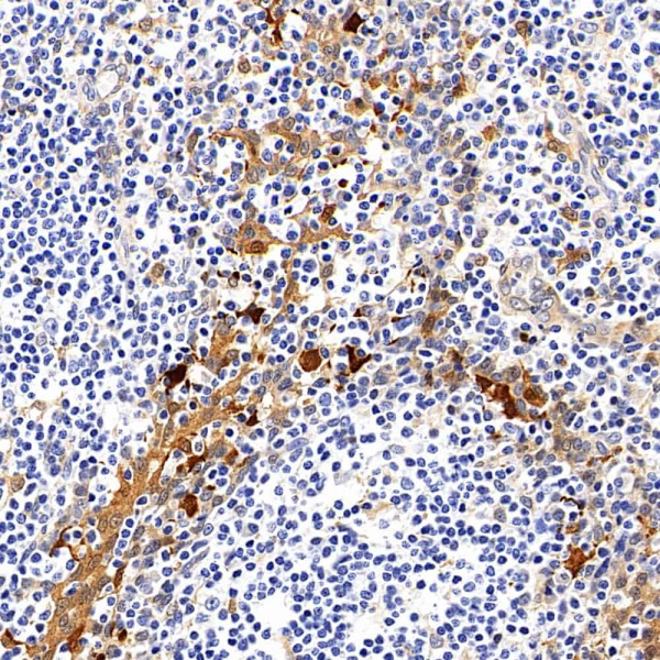 Galectin 3 Monoclonal Antibody (E-AB-70177)
