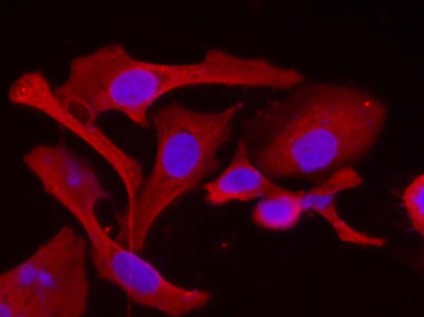 HSP-27 Polyclonal Antibody (AN005840L)