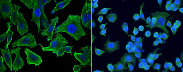 MCP-3/CCL7 Monoclonal Antibody (AN200217P)