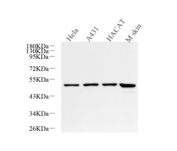 CK-17 Polyclonal Antibody (E-AB-70242)