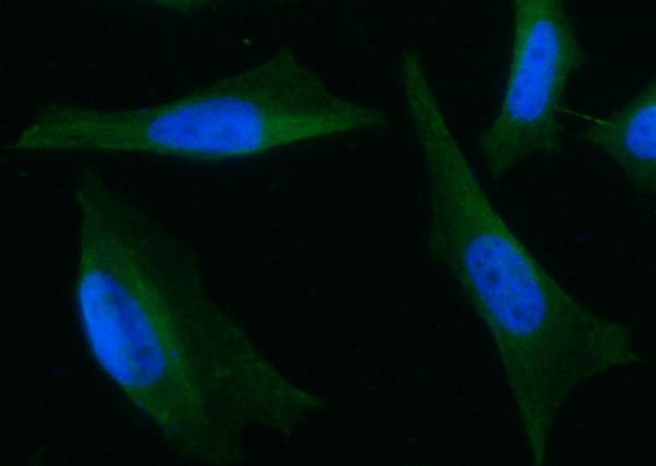 ARD1 Monoclonal Antibody (AN200239P)