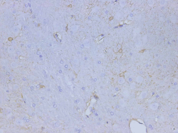 S100B Polyclonal Antibody (D-AB-10368L)