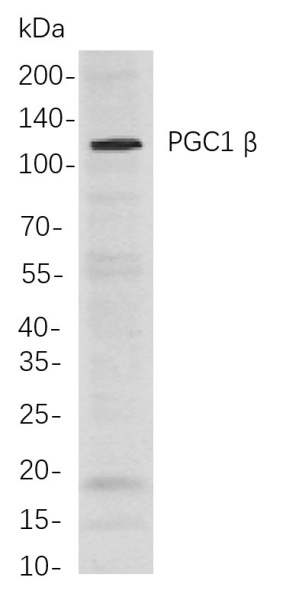 Recombinant PGC1 β Monoclonal Antibody (AN300994L)