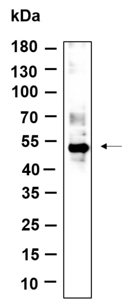 Recombinant Phospho-p53 (Ser46) Monoclonal Antibody (AN301140L)