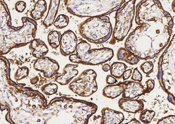 Recombinant CD98/SLC3A2 Monoclonal Antibody (AN300419P)