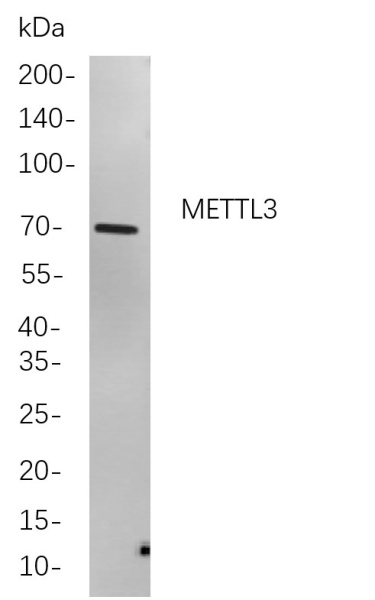 Recombinant METTL3 Monoclonal Antibody (AN301064L)