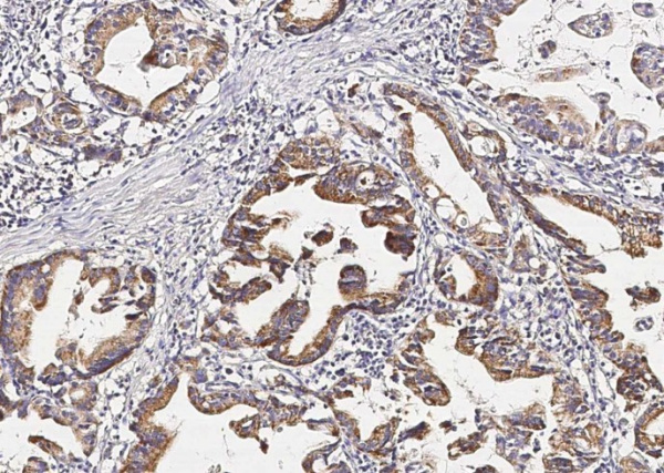 Recombinant PGA4 Monoclonal Antibody (AN300432P)