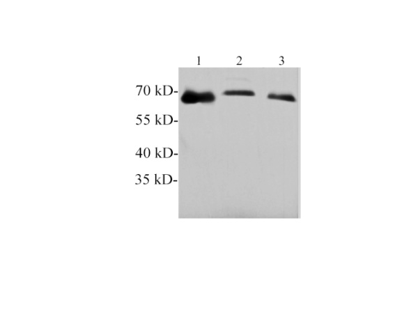 Tyrosine hydroxylase Polyclonal Antibody (E-AB-40585)