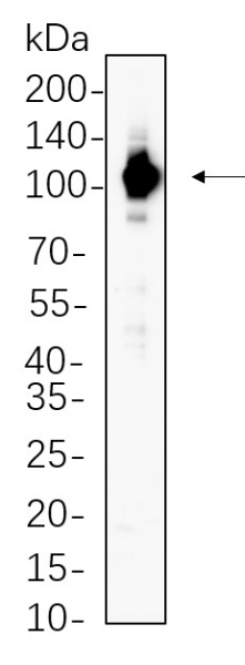 Recombinant STAT6 Monoclonal Antibody (AN300728L)