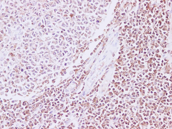 RAC2 Polyclonal Antibody (E-AB-40245)