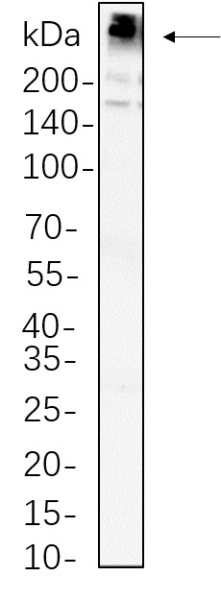 Recombinant Fatty Acid Synthase Monoclonal Antibody (AN300835L)