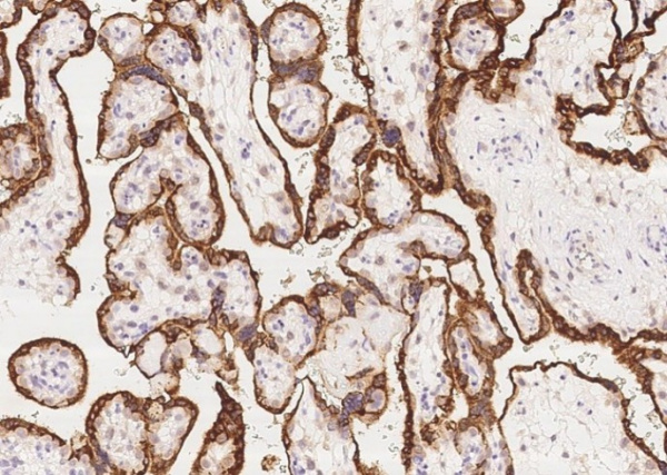 Recombinant Growth Hormone/GH1 Monoclonal Antibody (AN300056P)