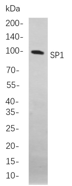 Recombinant SP1 Monoclonal Antibody (AN301087L)