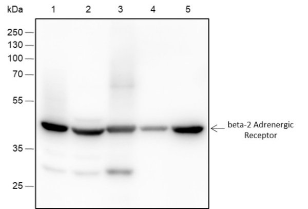 Recombinant beta-2 Adrenergic Receptor Monoclonal Antibody (AN301445L)