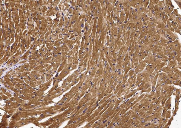 Recombinant gp130/CD130/IL6ST Monoclonal Antibody (AN300483P)