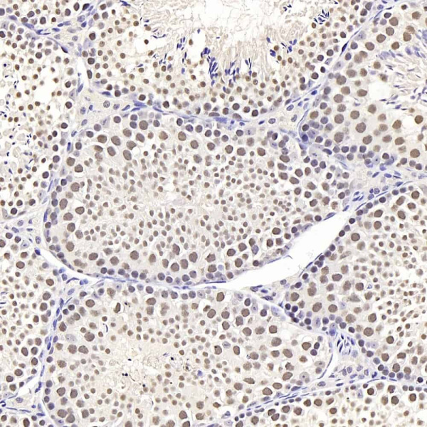 SIRT1 Polyclonal Antibody (E-AB-70368)