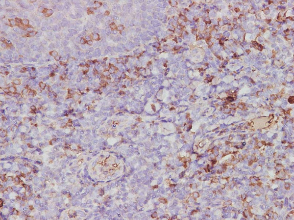 CXCL2/GRO beta Polyclonal Antibody (AN005990L)