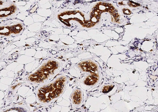 Recombinant c-Kit/CD117 Monoclonal Antibody (AN300410P)