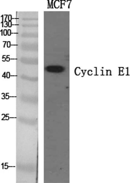 Cyclin E1 Polyclonal Antibody (E-AB-31074)