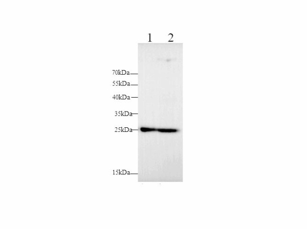 MMP-7 Polyclonal Antibody (E-AB-40656)