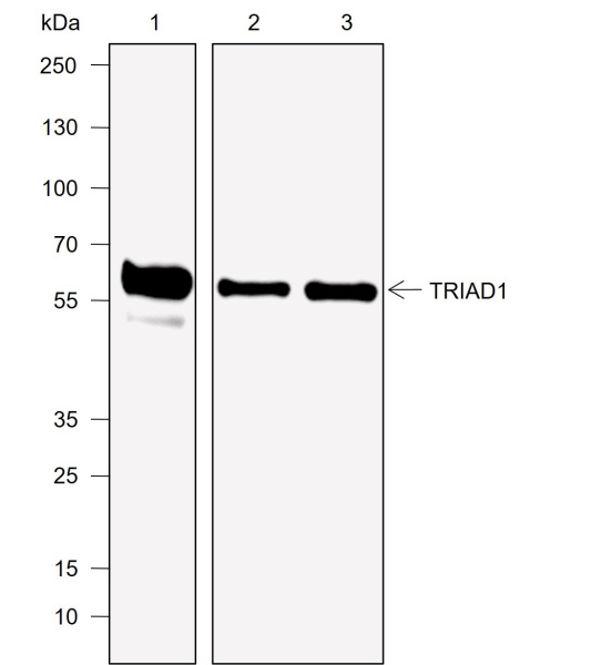 Recombinant TRIAD1 Monoclonal Antibody (AN302043L)