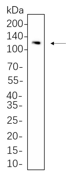 Recombinant STAT2 Monoclonal Antibody (AN300672L)